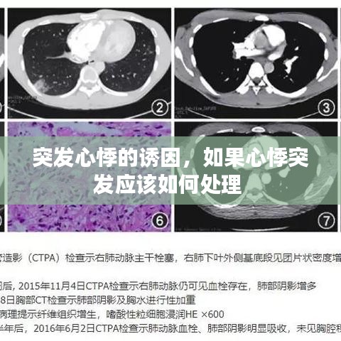 突发心悸的诱因，如果心悸突发应该如何处理 