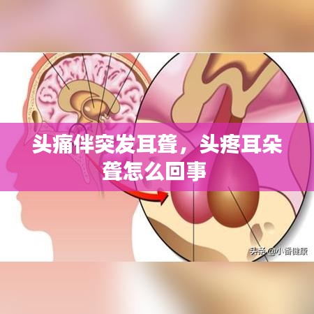 头痛伴突发耳聋，头疼耳朵聋怎么回事 