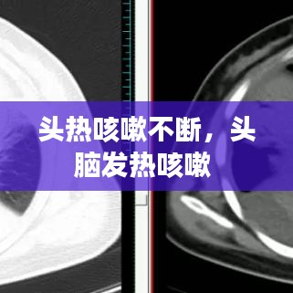 头热咳嗽不断，头脑发热咳嗽 