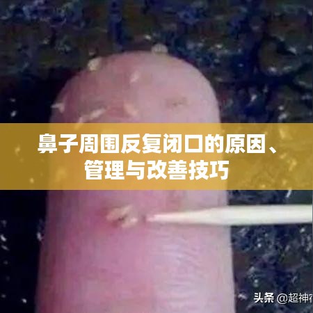 鼻子周围反复闭口的原因、管理与改善技巧