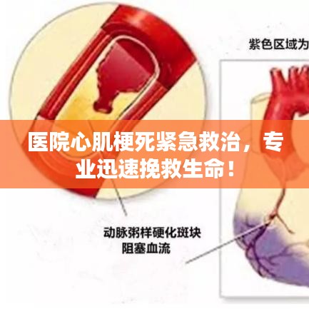 医院心肌梗死紧急救治，专业迅速挽救生命！
