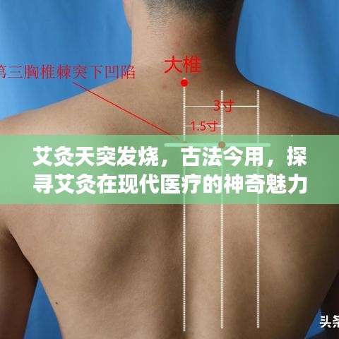 艾灸天突发烧，古法今用，探寻艾灸在现代医疗的神奇魅力