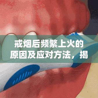 戒烟后频繁上火的原因及应对方法，揭秘策略与解决方案