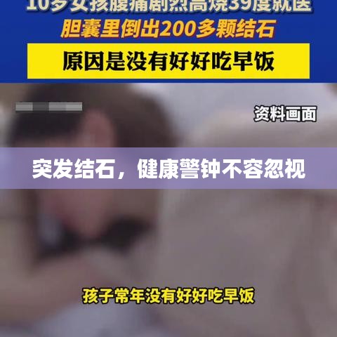突发结石，健康警钟不容忽视