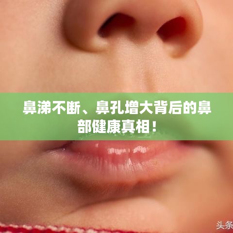 鼻涕不断、鼻孔增大背后的鼻部健康真相！