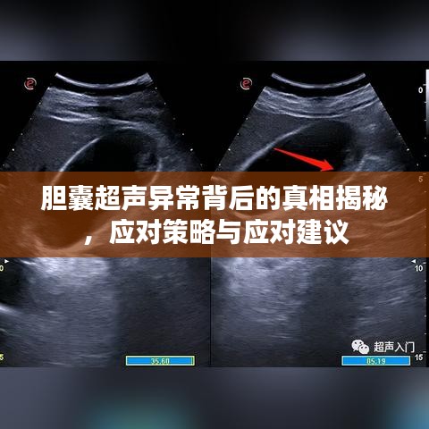 胆囊超声异常背后的真相揭秘，应对策略与应对建议