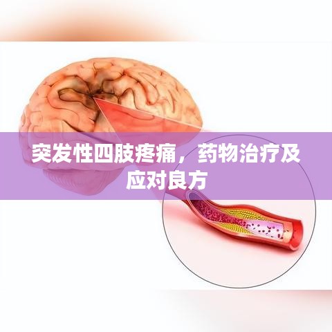 突发性四肢疼痛，药物治疗及应对良方