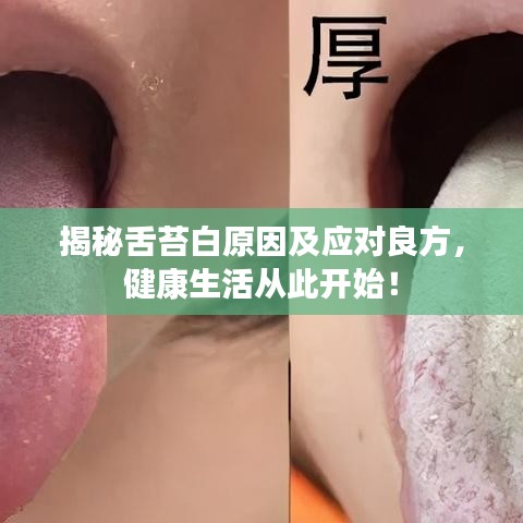 揭秘舌苔白原因及应对良方，健康生活从此开始！
