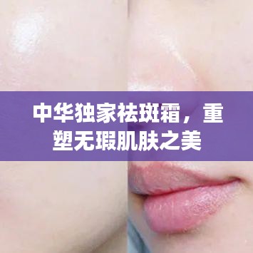 中华独家祛斑霜，重塑无瑕肌肤之美